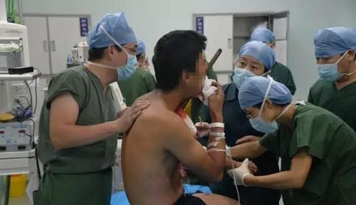 驚險！濱州一小伙嘴里插進1.5米鋼筋 濱醫(yī)附院多科室聯(lián)合手術3小時取出