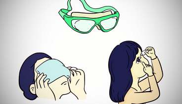 春季過敏性結(jié)膜炎進(jìn)入高發(fā)期｜山東大學(xué)齊魯醫(yī)院德州醫(yī)院專家提醒：揉眼止癢存感染風(fēng)險(xiǎn) 科學(xué)防治需雙管齊下