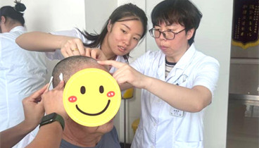 濱州醫(yī)學(xué)院煙臺附屬醫(yī)院岐黃腦針：聚焦腦卒中后遺癥康復(fù)，解鎖中醫(yī)精準(zhǔn)治療新高度